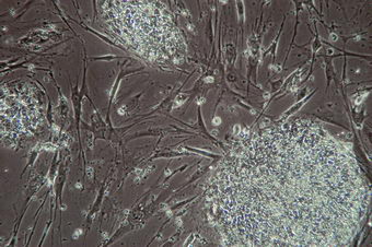 Scientists grow two new stem cell lines in animal cell-free culture