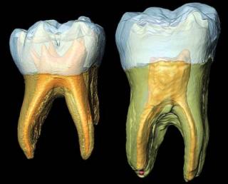 Daily grind: Fossil molars add to Neanderthal debate