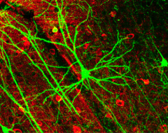 photo of Why developing nerve cells can take a wrong turn image