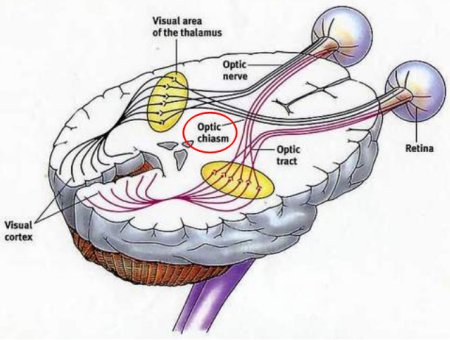 Optic Nerve Chiasm
