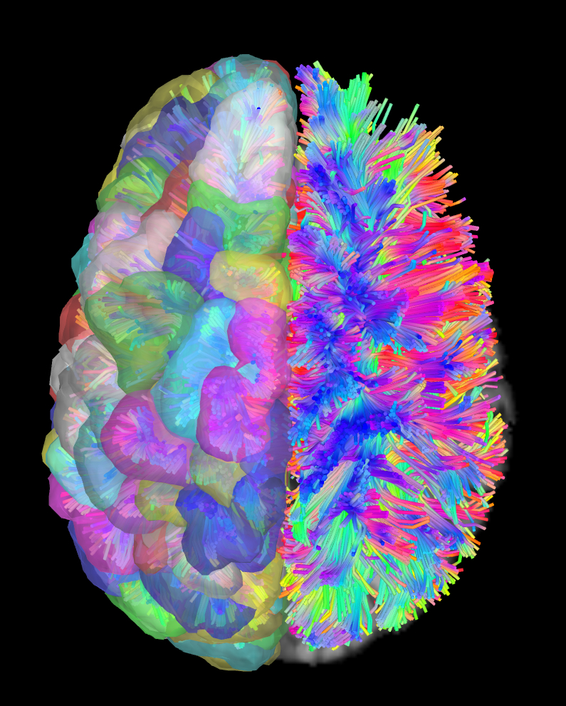 Colored brains. Нейробиология мозга. Brain Neural small. Brain in the most beautiful.