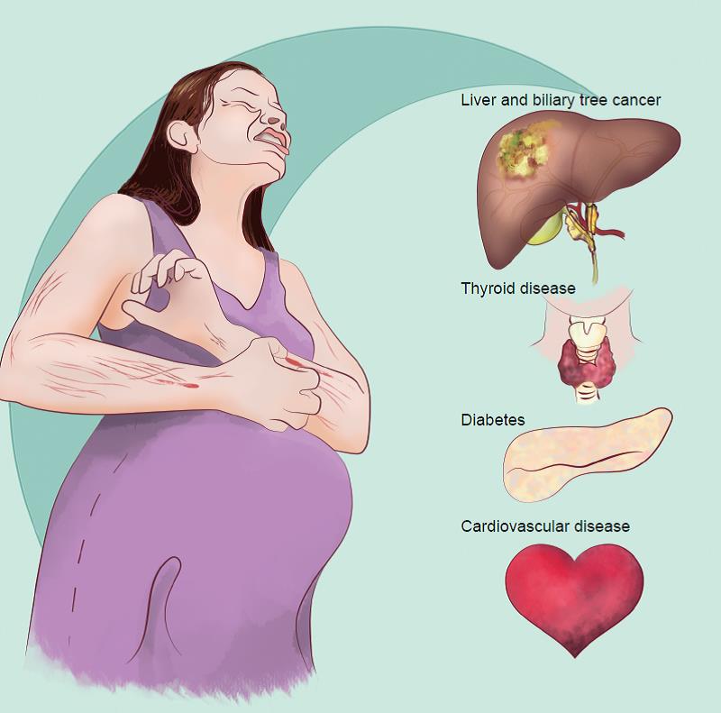 hepatic cancer and pregnancy)