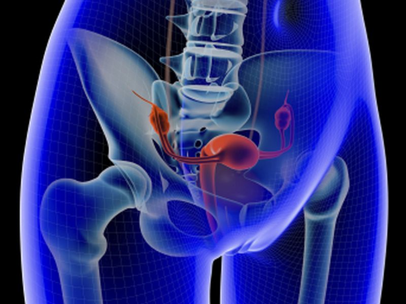 A) A three-dimensional image of the pelvic well pad (blue). It is