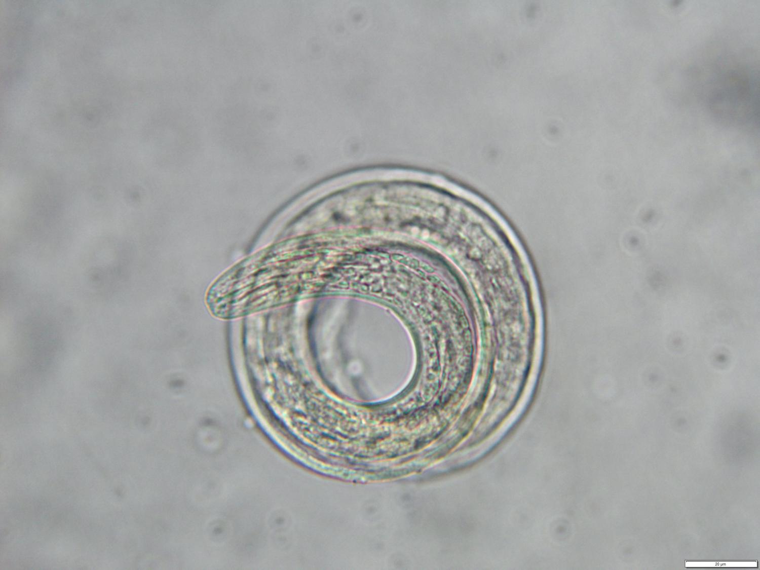 schistosomiasis florida a cernagilis tünetei gyermekeknél