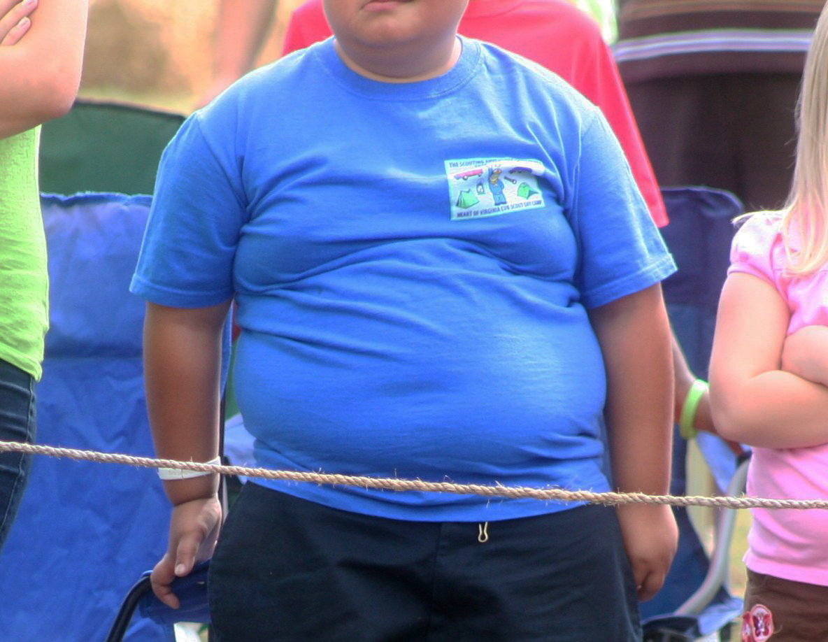 Фото ожирения у детей