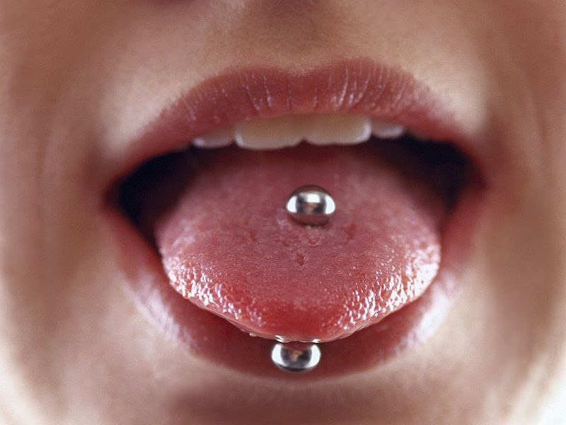 cocaïne Verenigen Defecte Periodontal inflammation a risk with tongue piercing