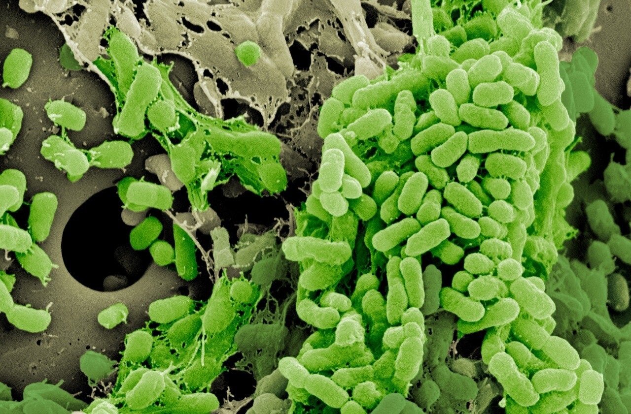 Микроорганизмы обитающие в почве относятся к группе