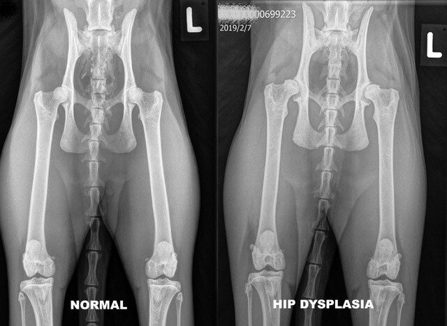 normal hip vs hip dysplasia xray