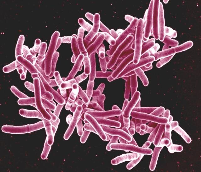 Researchers develop new technology to easily detect active TB