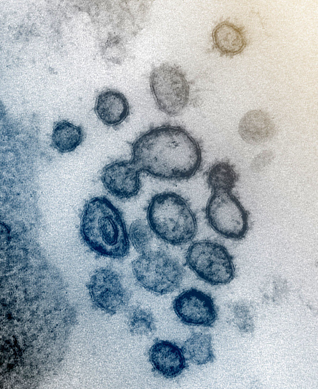 Moderna Early Coronavirus Vaccine Results Are Encouraging