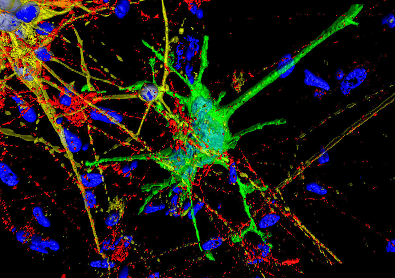 Астроциты мозга. Нейроны мозга. Астроциты. Астроцит и Нейрон. Астроциты фото.
