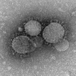 Virologist offers scientific context for ongoing coronavirus outbreak