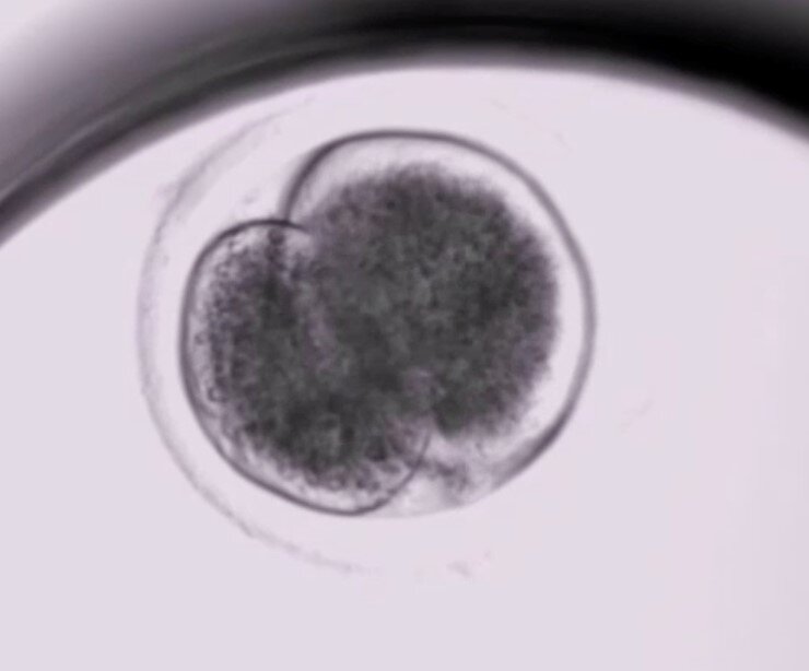 Embryonic development in slow motion