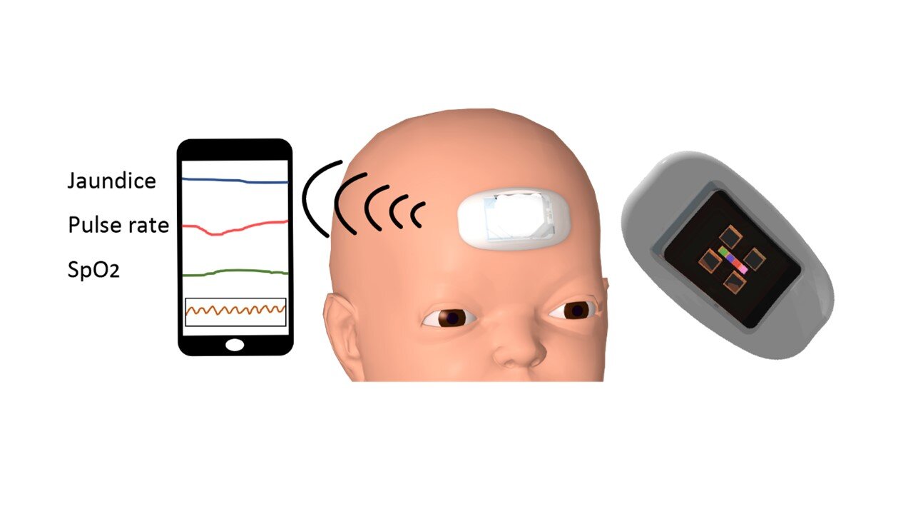 Wearable device for tracking temperature of paediatric blood cancer  patients at home - BJH