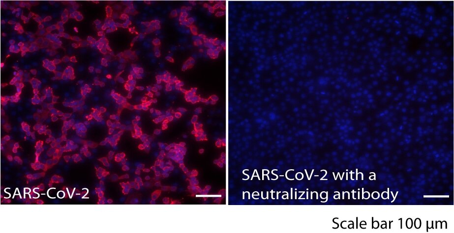 Most people are naturally armed with SARS-CoV-2: study