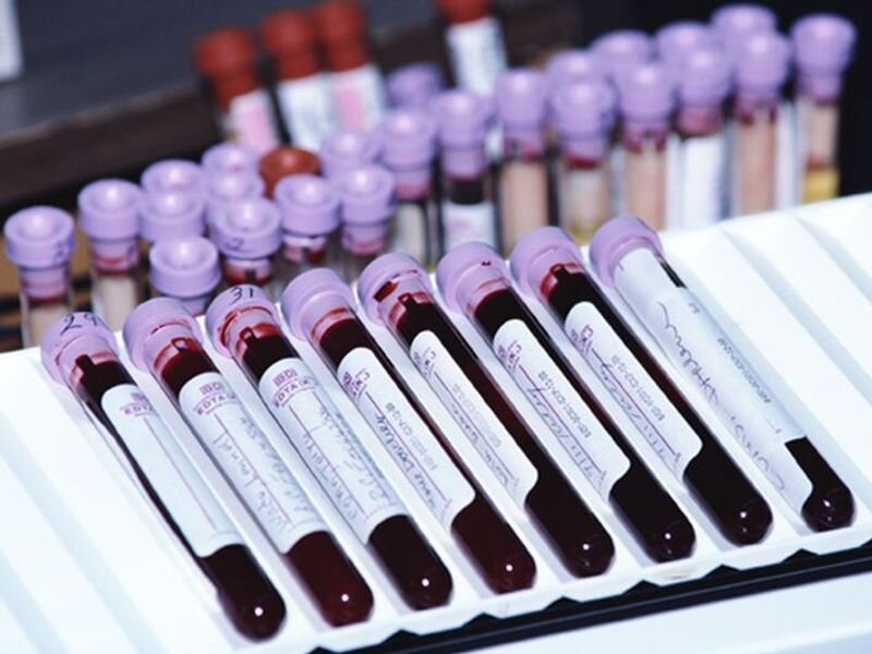 Study refutes the theory that blood type affects COVID risk