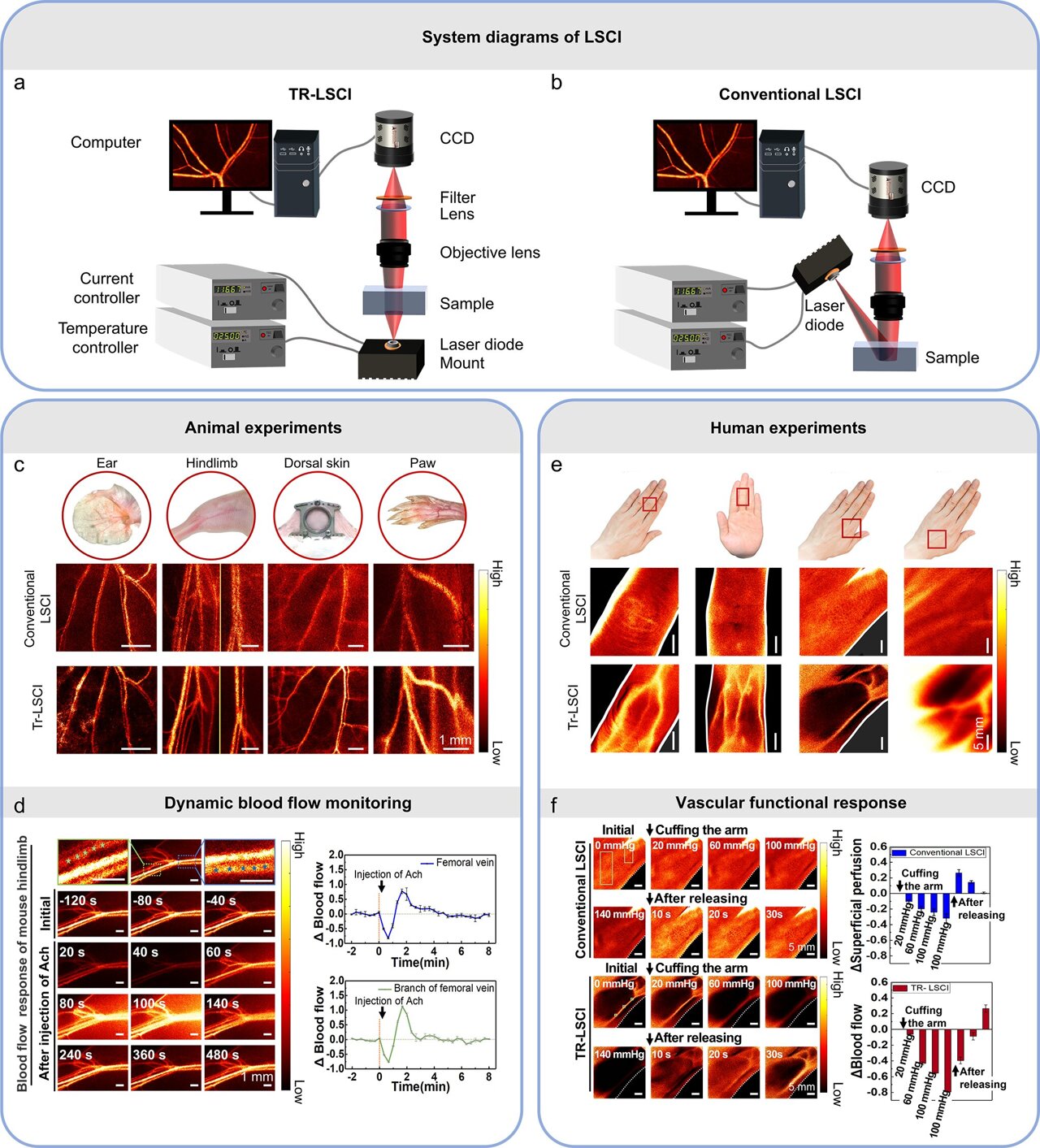 Transmissive-detected laser speckle imaging for blood flow monitoring in thick tissue