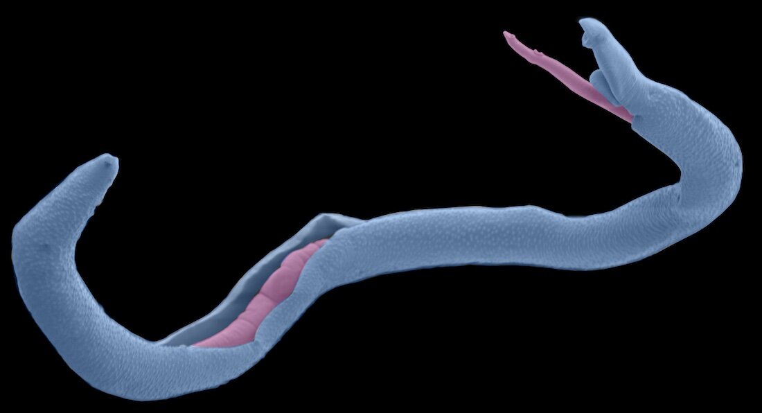 Discovery provides insight into neglected tropical disease schistosomiasis
