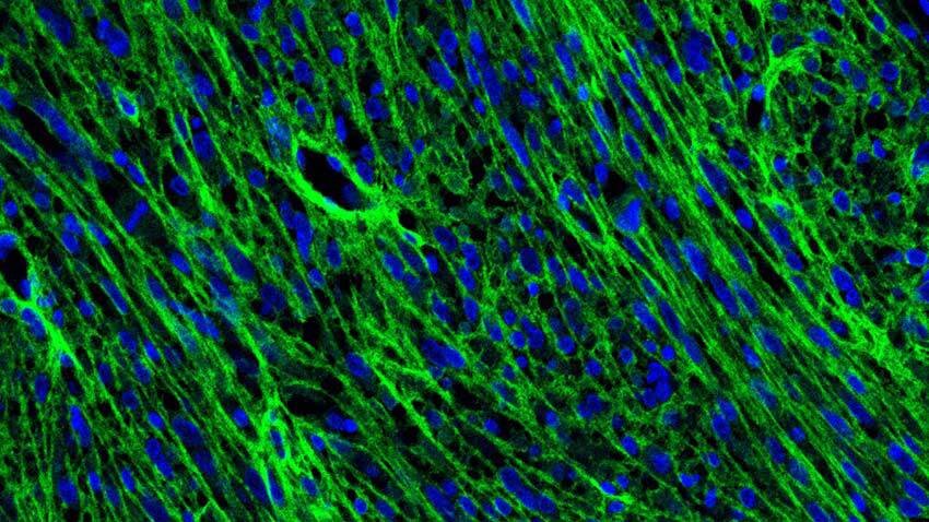 #Dynamic cells linked to brain tumor growth and recurrence