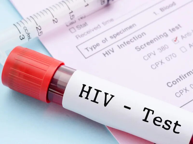 Testy na HIV spadły podczas pandemii