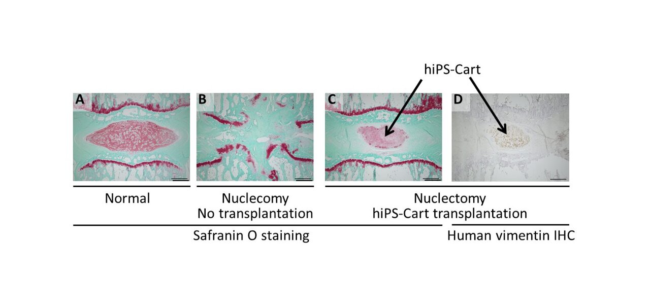 Injectable stem cell assembly for cartilage regeneration