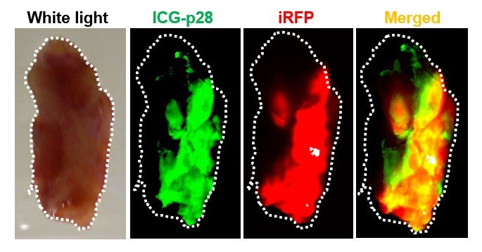 Near-infrared light fluorescence in mice optimizes tumor removal, reduces cancer recurrence