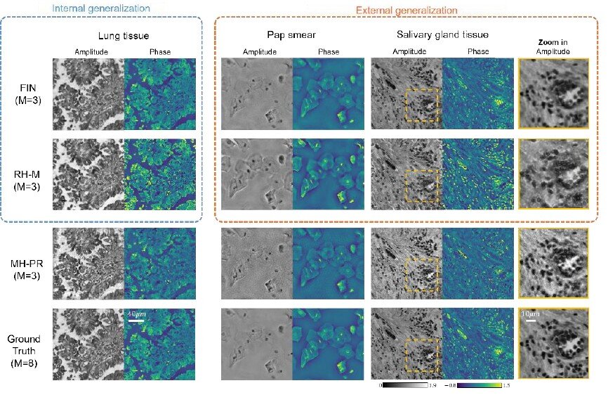 Le réseau de neurones accélère la reconstruction de l’image 3D d’échantillons biologiques