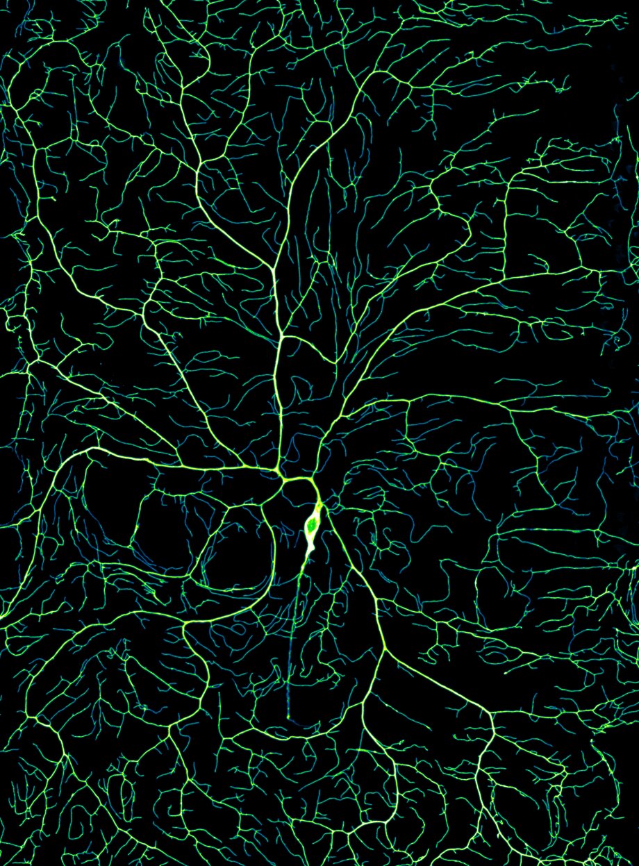 Investigadores visualizan la compleja ramificación del sistema nervioso