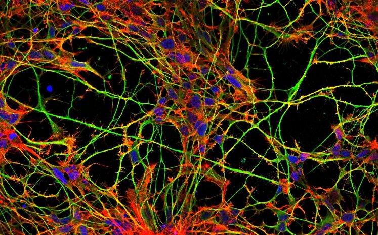 Researchers investigate effects of tau proteins on microtubules within nerve cel..