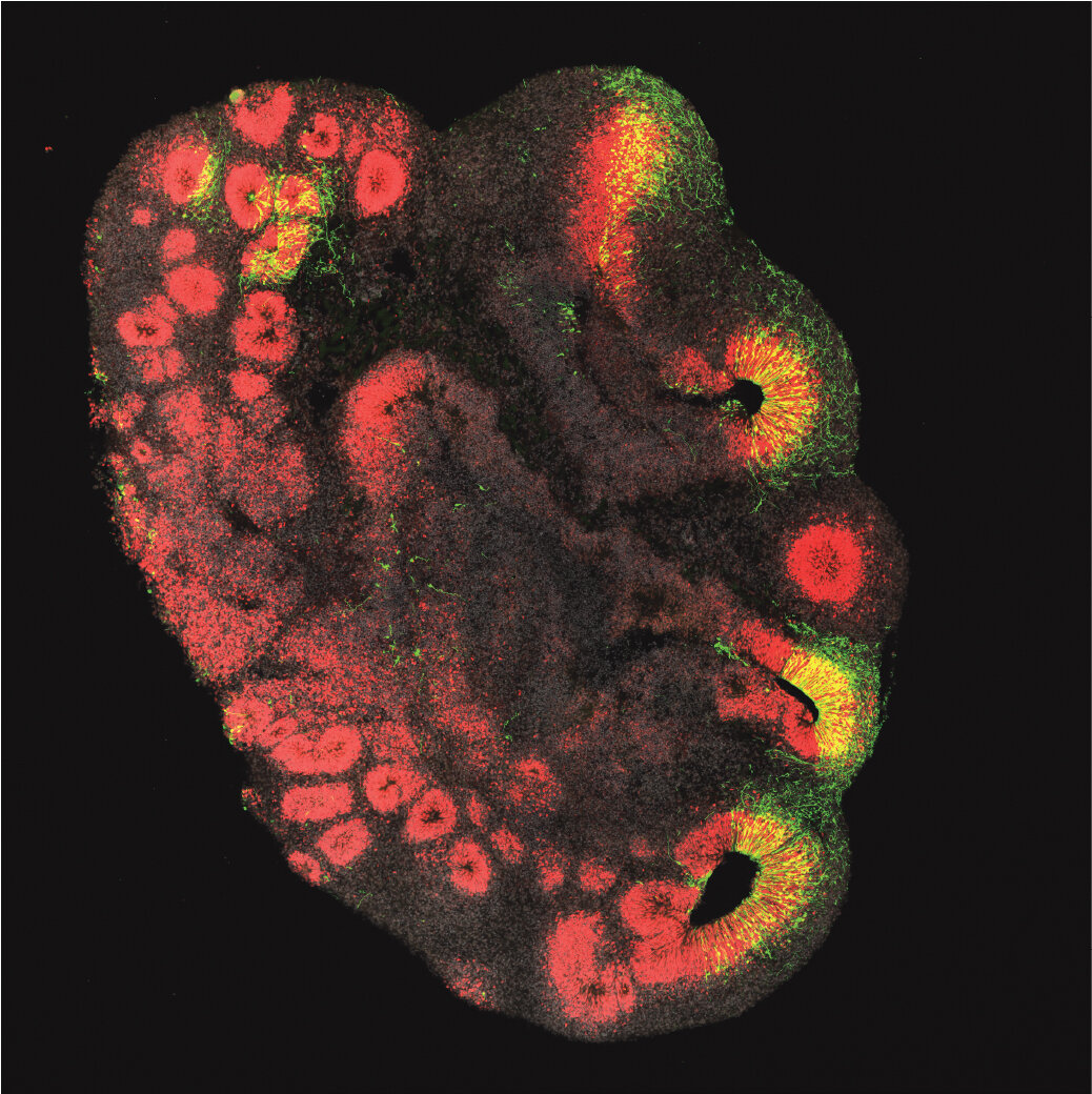 Brain organoids provide insights into the evolution of the human brain