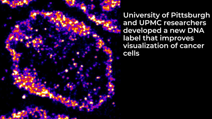 #New fluorescent DNA label reveals nanoscopic cancer features