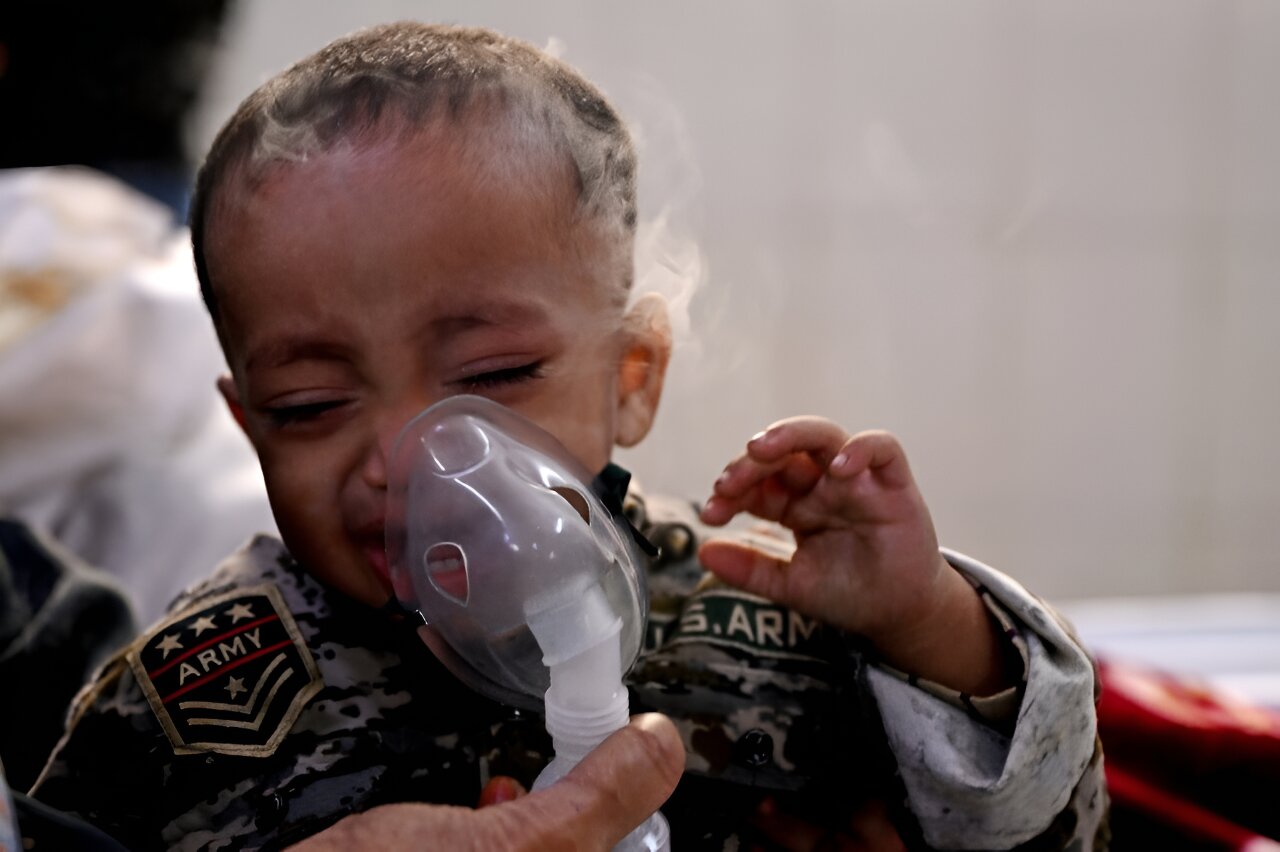 Delhi children hardest hit by smog