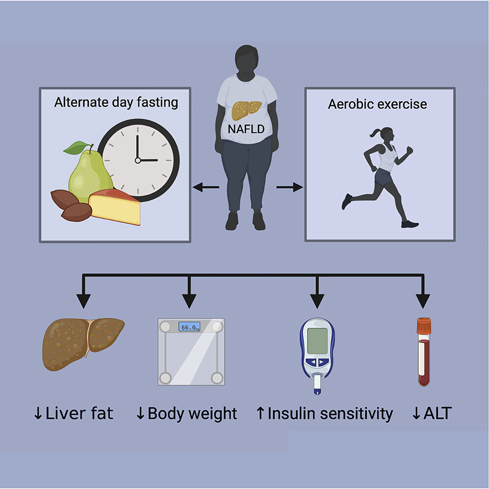 Alternate-day fasting and metabolic rate