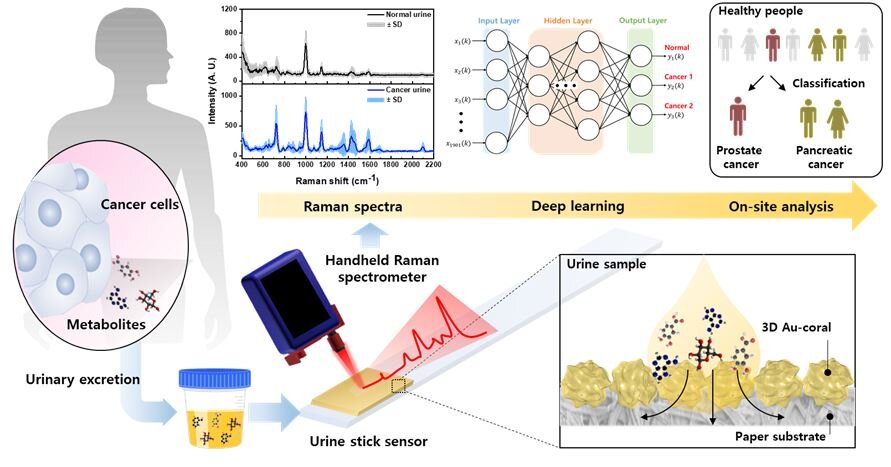 #3D plasmonic coral nanoarchitecture for cancer diagnosis using urine