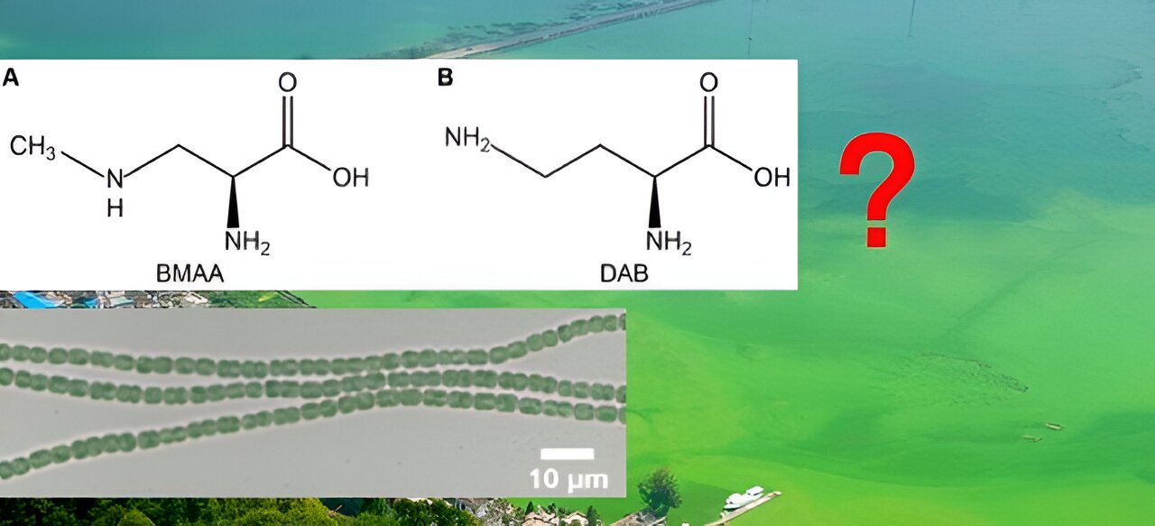 photo of Do cyanobacteria make the neurotoxin β-N-methylamino-L-alanine? image