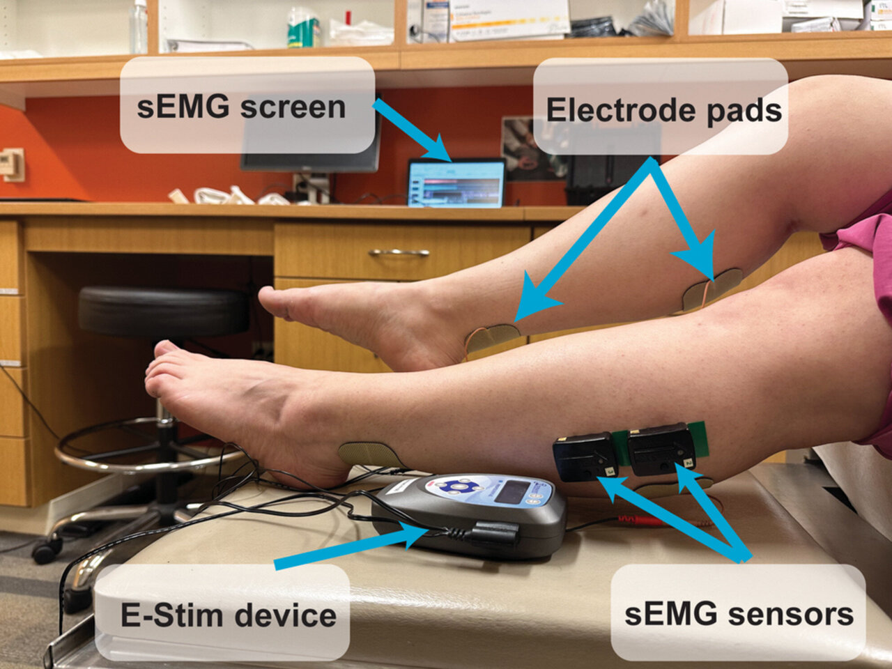 Electrical stimulation found to revitalize muscle perfusion caused