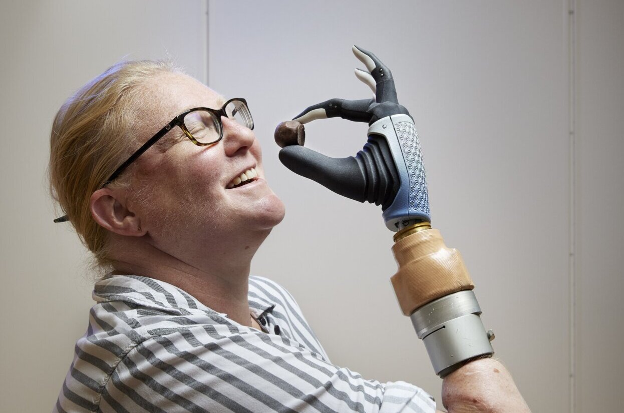 Groundbreaking' bionic arm that fuses with user's skeleton and