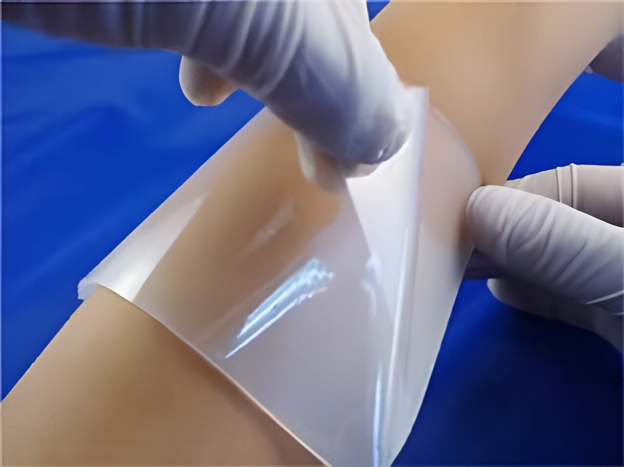 Scientists develop new hydrogels for wound management