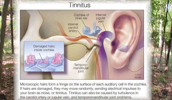 When the Noise Never Stops: Coping With the Challenges of Tinnitus. – Houri  Hearing Lebanon