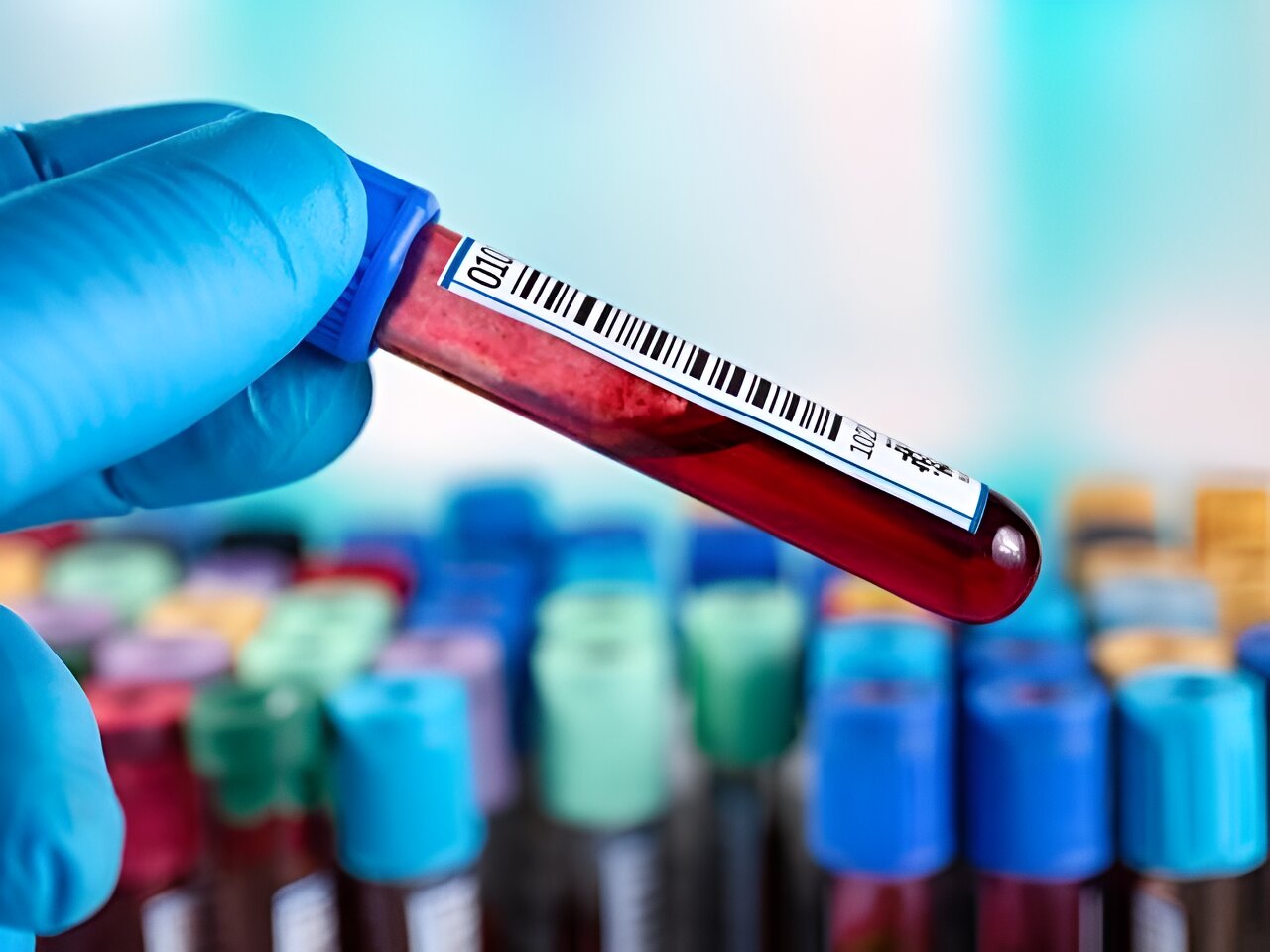 Multicancer early detection blood tests are feasible, study suggests
