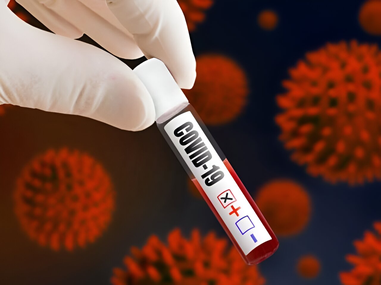 What to Know About EG.5 (Eris)—the Latest Coronavirus Strain > News > Yale  Medicine