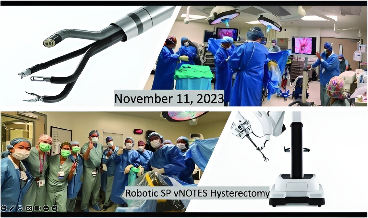 Nowa jednoportowa platforma robotyczna do chirurgii laparoskopowej przeprowadzanej przez naturalny otwór pochwy