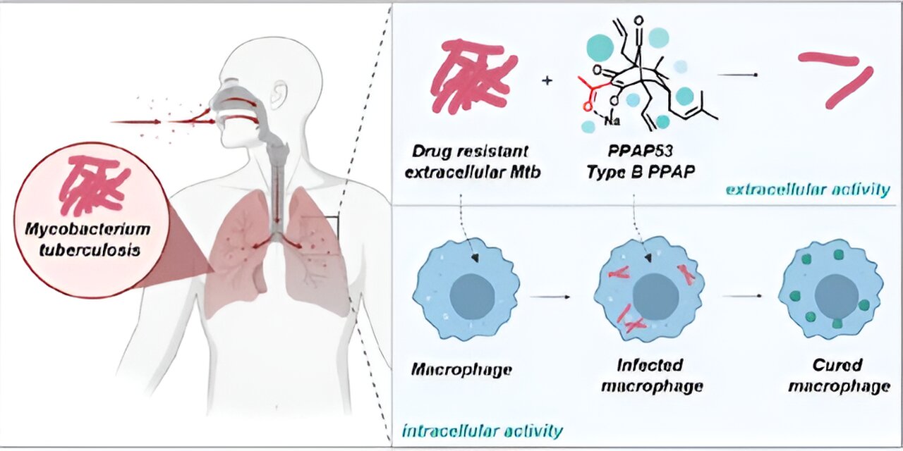 A Novel Tool to Identify Bactericidal Compounds against Vulnerable Targets  in Drug-Tolerant M. tuberculosis found in Caseum