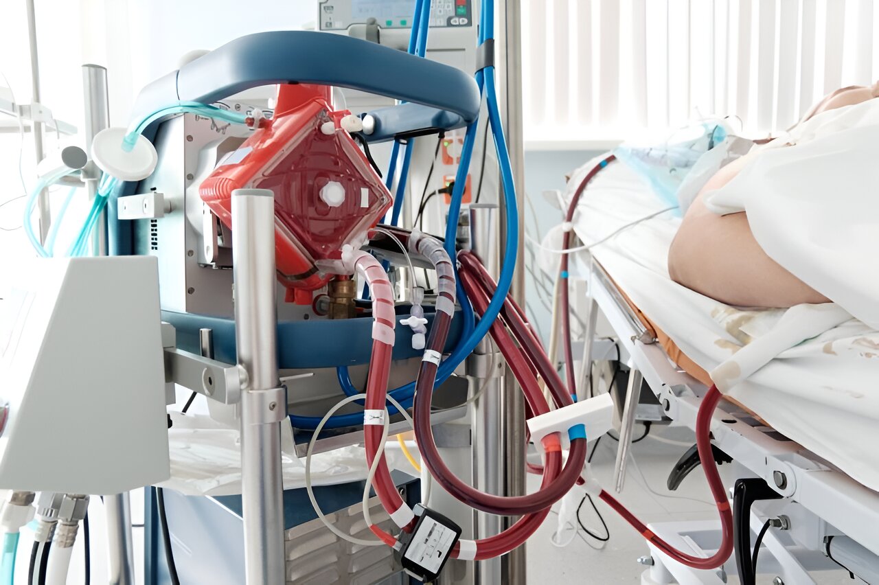 #Prone positioning does not cut time to weaning in ARDS with VV-ECMO
