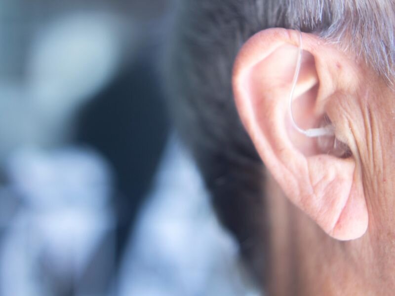 Self-fitting, over-the-counter hearing aids beneficial