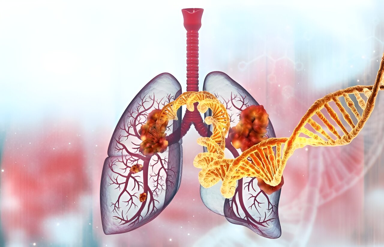 Study identifies familial germline EGFR T790M variant in lung cancer
