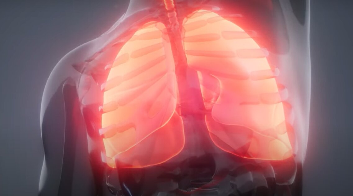 #How robotic bronchoscopy helps diagnose lung cancer