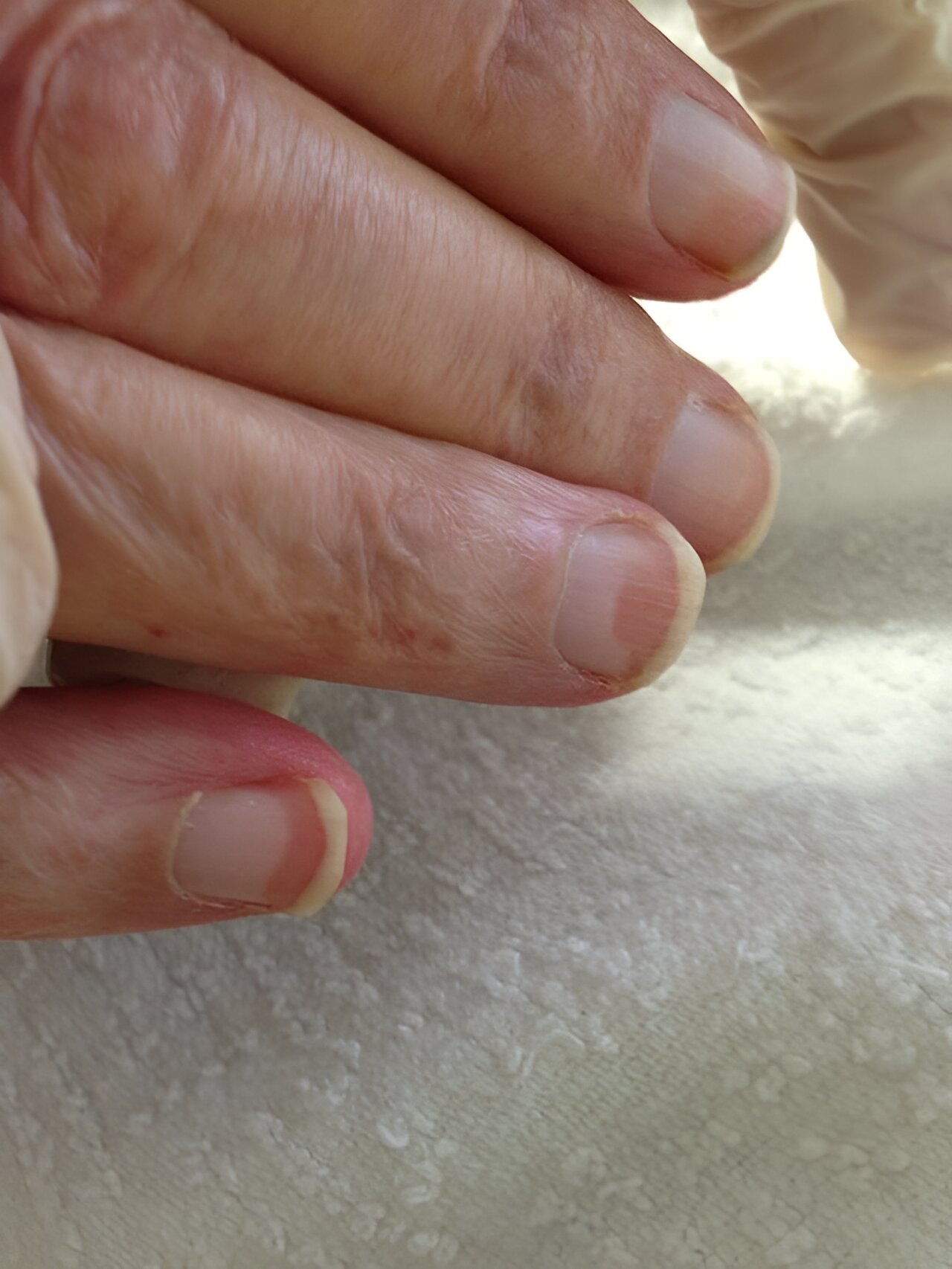What Do Your Brittle Nails Say About Your Health?