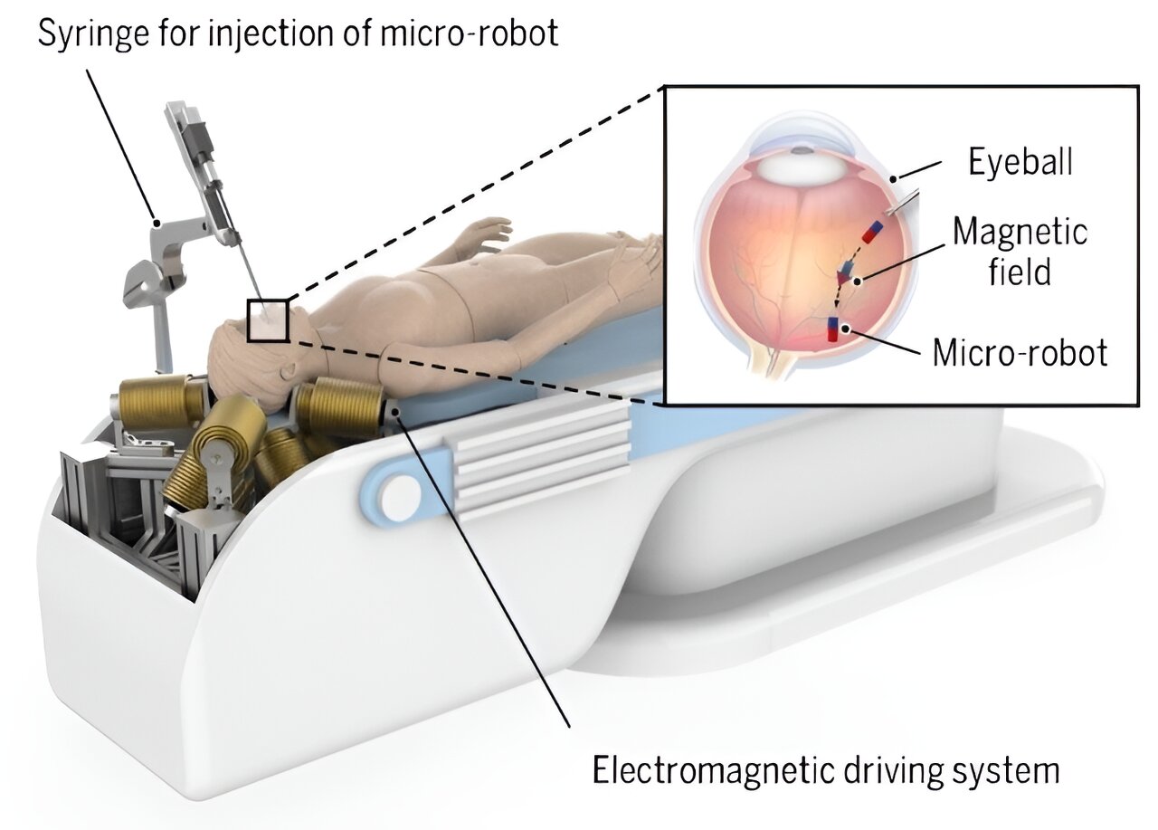 #Researchers develop electromagnetic driving system to enhance intraocular microsurgery