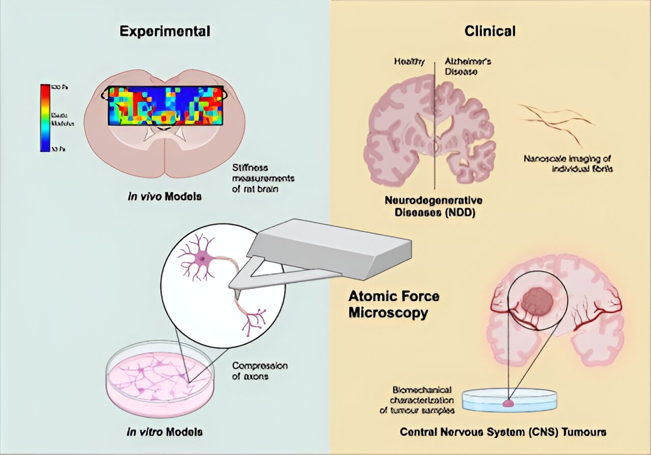 原子力显微镜在神经系统疾病的表征和临床评估中的应用